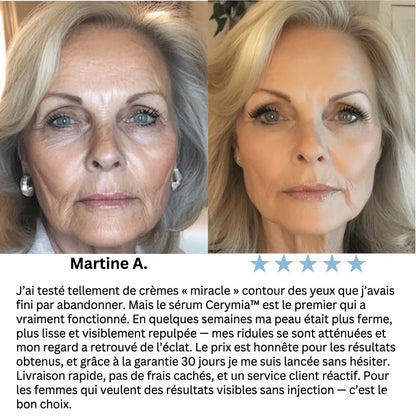 Cerymia | Sérum Coréen Anti-Cernes à la Volufiline™