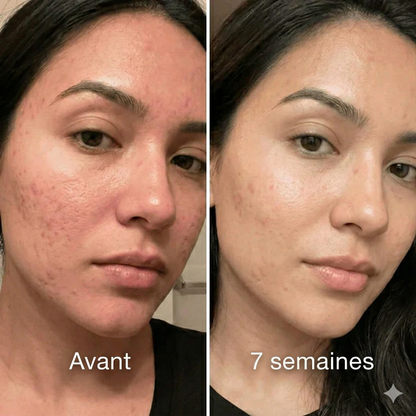 Stick Réparateur Anti-Cicatrices™