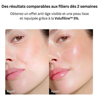 Cerymia | Sérum Coréen Anti-Cernes à la Volufiline™