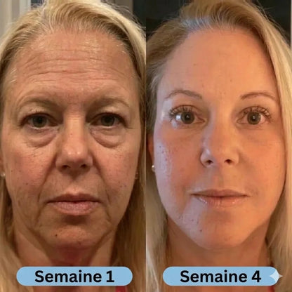 Cerymia | Sérum Coréen Anti-Cernes à la Volufiline™