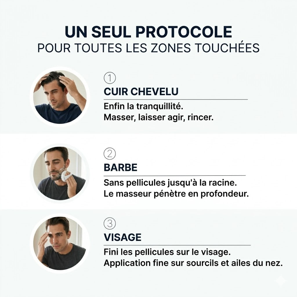 Vos pellicules reviennent ? Plus maintenant.