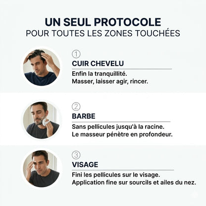 Vos pellicules reviennent ? Plus maintenant.