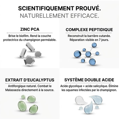 Vos pellicules reviennent ? Plus maintenant.